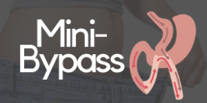 mini bypass